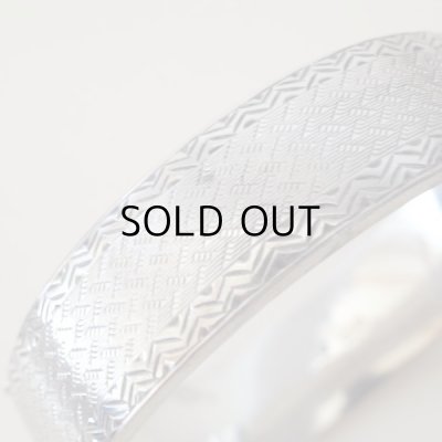 凹みがみられます