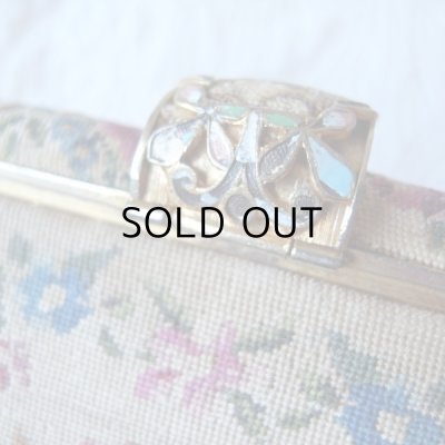 エナメルが剥がれている部分があります